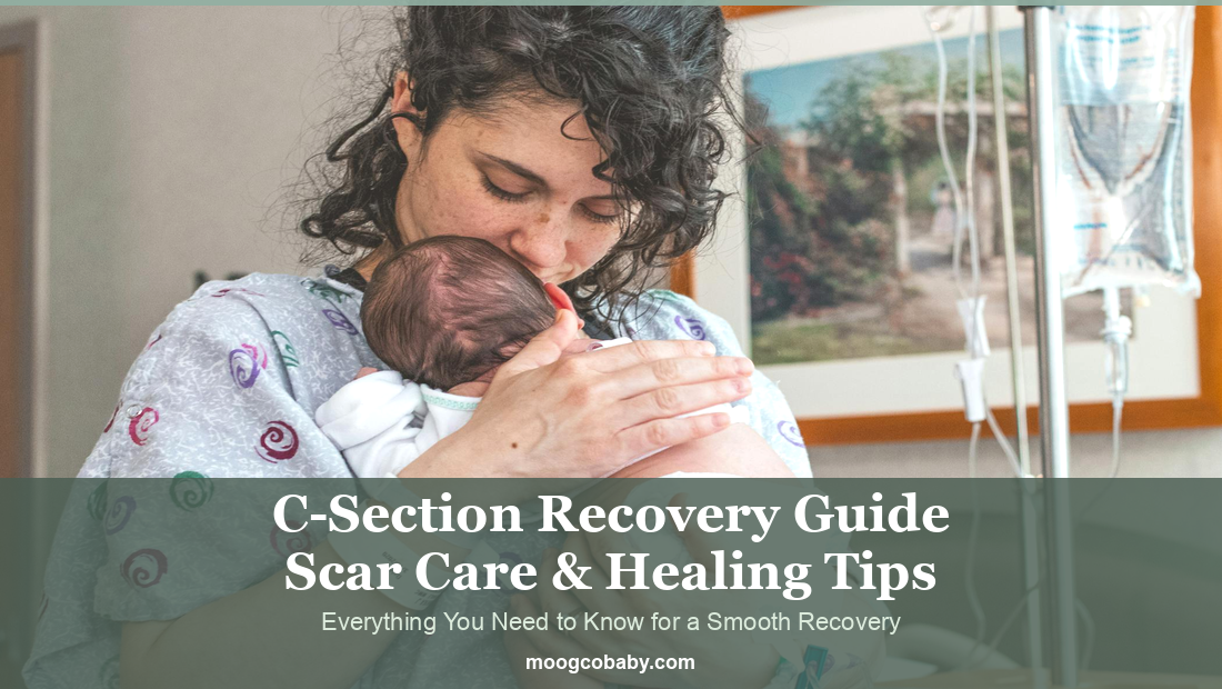 C-Section Recovery Guide: Scar Care, Healing Tips & What to Expect (2026)