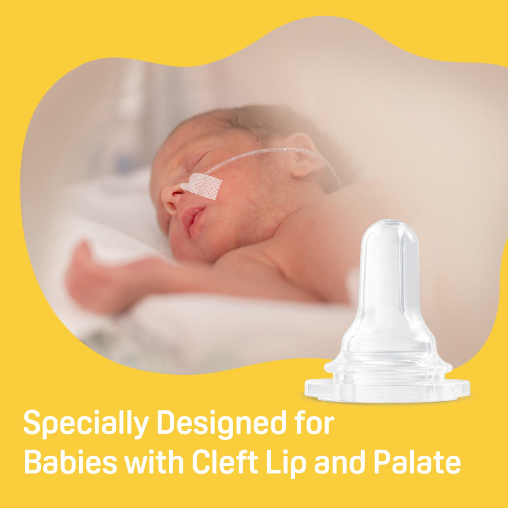 Baby cleft lip/palate bottle with 2 nipples, 8.11 oz, designed for infants with special feeding needs.