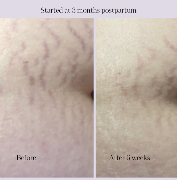 Revitalize Postpartum Cream 4oz