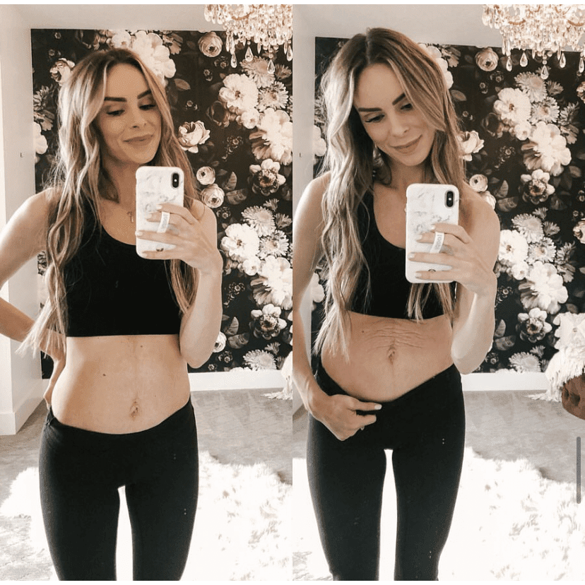 Tummy Butter Post Pregnancy Stretch Mark Cream for effective postpartum skin care and stretch mark removal.