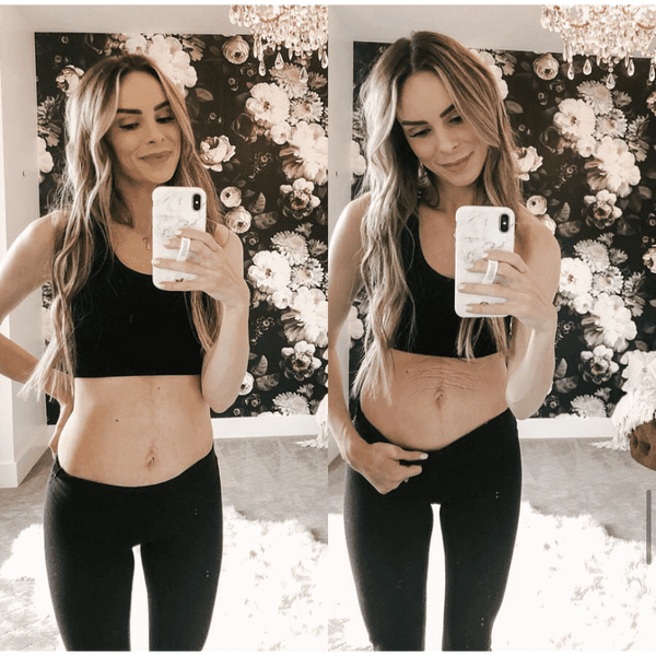 Tummy Butter Post Pregnancy Stretch Mark Cream