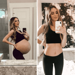 Stretch Mark Treatment Kit