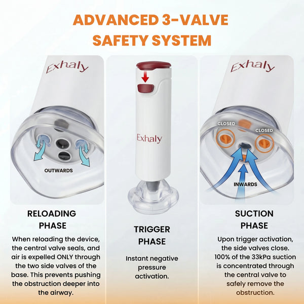 Exhaly Automatic Anti-Choking Rescue Device by Rivona LLC