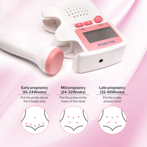SpringBud FD-200B Fetal Doppler Hearbeat Monitor FDA Cleared - MOOGCO Baby