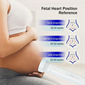 SpringBud FD-300B Fetal Doppler FDA Cleared