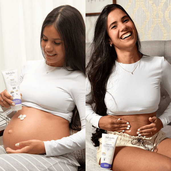 Baby Jolie Paris Triple Action Stretch Marks Cream 7.5oz